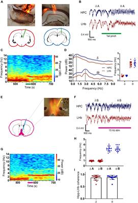 Volume-Conducted Origin of the Field Potential at the Lateral Habenula